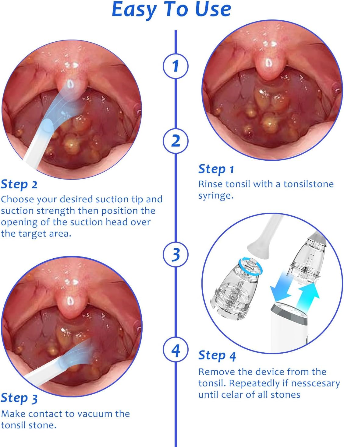 8 Suction Modes 3 Levels Tonsi - Electronics And Gadgets recension och pris